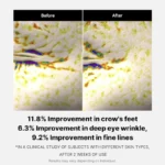 قبل-و-بعد-از-استفاده-از-دور-چشم-مدیکیوب