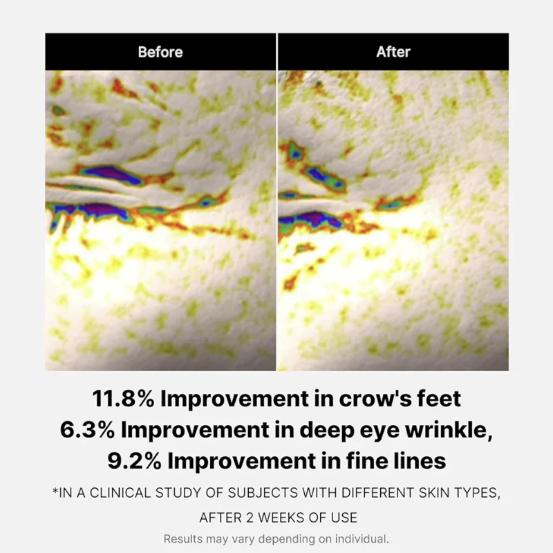 کرم دور چشم لیفتینگ مدی کیوب حاوی پپتید حجم 30 میل - Image 3